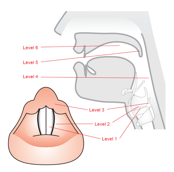 Levels of the Vocal Tract
