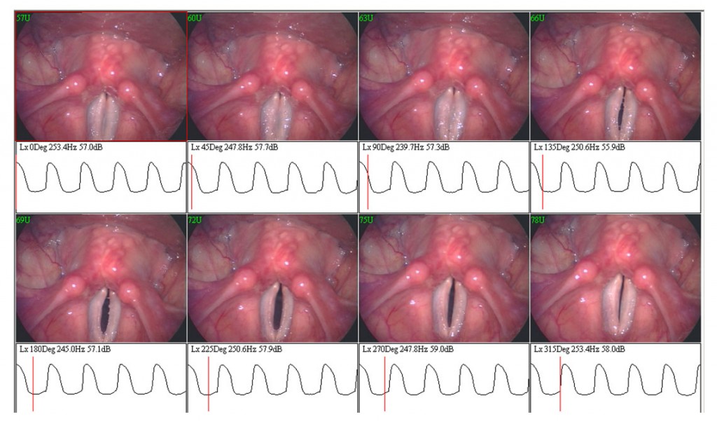 Synchronised-Lx-with-stroboscopy-