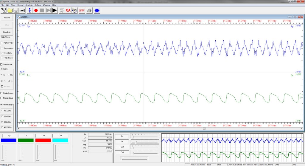 Fig3 Lx and Sp waveforms Speech studio screenshot